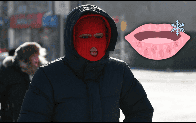 En época de frío se incrementan los problemas en la piel debido a la exposición directa a las condiciones climáticas. AFP / ARCHIVO