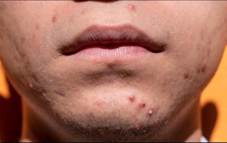 Muchas personas han descubierto que adoptar buenos hábitos es clave para el cuidado de la piel, uno de los órganos más importantes del cuerpo humano. Pixabay