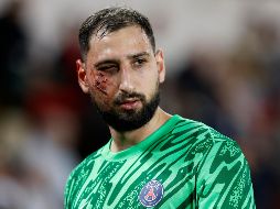 Gianluigi Donnarumma recibió una patada en la cara que forzó su salida al minuto 20 del partido en el que su equipo se impuso frente al Mónaco. EFE/S. Nogier