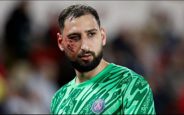 Gianluigi Donnarumma recibió una patada en la cara que forzó su salida al minuto 20 del partido en el que su equipo se impuso frente al Mónaco. EFE/S. Nogier