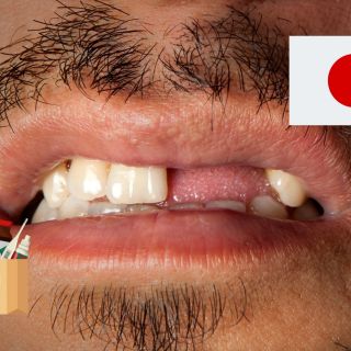 Investigadores de Japón prueban un fármaco para regenerar dientes