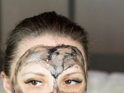 Este es uno de los múltiples tratamientos caseros para combatir el acné. ESPECIAL / UNSPLASH Bermix Studio