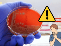 Además, la resistencia antimicrobiana afectará procedimientos médicos críticos, como trasplantes de órganos, tratamientos de quimioterapia y cirugías mayores, incrementando los riesgos para los pacientes. CANVA