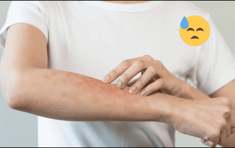 Es importante consultar a un médico si persisten las molestias. UNSPLASH / M. GRYFFYN