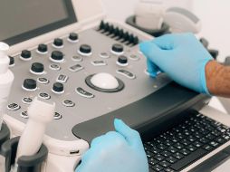 A través de algoritmos de aprendizaje automático, los sistemas de IA pueden analizar grandes volúmenes de datos médicos. UNSPLASH / E. SHERr