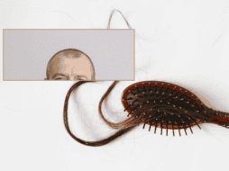 Cambiar hábitos de la vida cotidiana pueden ayudar a reducir o evitar la pérdida del cabello excesiva. ESPECIAL/Imagen de Phimchanok Srisuriyamart en Pixabay/Imagen de Anna Shvets en Pexels