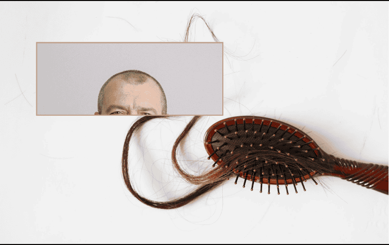 Cambiar hábitos de la vida cotidiana pueden ayudar a reducir o evitar la pérdida del cabello excesiva. ESPECIAL/Imagen de Phimchanok Srisuriyamart en Pixabay/Imagen de Anna Shvets en Pexels