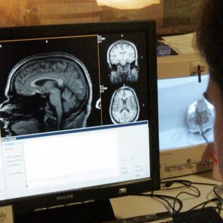 ¿Qué es la epilepsia y cómo tratarla?