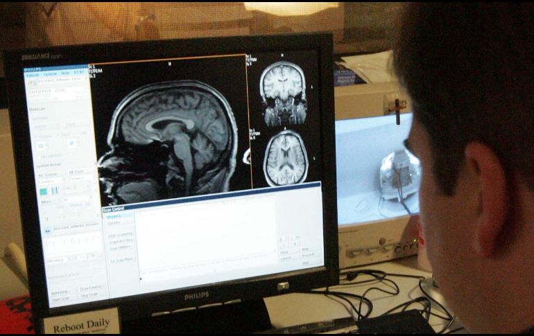 Aunque la epilepsia puede explicarse por genética o lesiones, en muchos casos se desconoce la causa. AP/Archivo