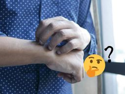 Aliviar la comezón razcando la zona empeora los síntomas y ralentiza la curación. ESPECIAL / Pexels y Canva