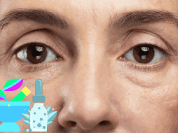 La aparición de ojeras pueden causar una apariencia cansada y poco estética en las personas en las que aparecen. CANVA/ ESPECIAL