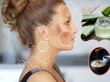 Existen remedios naturales que te pueden ayudar a reducir las manchas y mantener la salud de la piel. ESPECIAL / CANVA