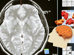 Un equipo internacional de científicos ha descubrió que el cerebro cuenta con varias regiones que forman un circuito común que se activa cuando el individuo lleva a cabo tareas creativas. ESPECIAL/ CANVA