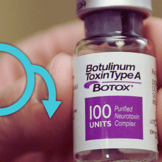 ¿Bótox para la disfunción eréctil? Así va la investigación