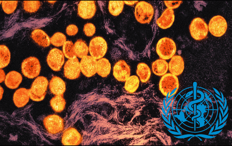 La variante menos letal de 2022 ya llevó a la OMS a una primera declaración de la emergencia sanitaria internacional. UNSPLASH / National Institute of Allergy and Infectious Diseases