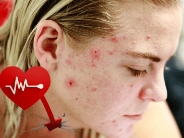 Es importante es llevar una alimentación balanceada con minerales y vitaminas. PEXELS / CANVA