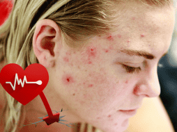 Es importante es llevar una alimentación balanceada con minerales y vitaminas. PEXELS / CANVA