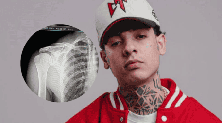 El cantante compartió en sus redes sociales que su cirugia salió bien. CORTESÍA