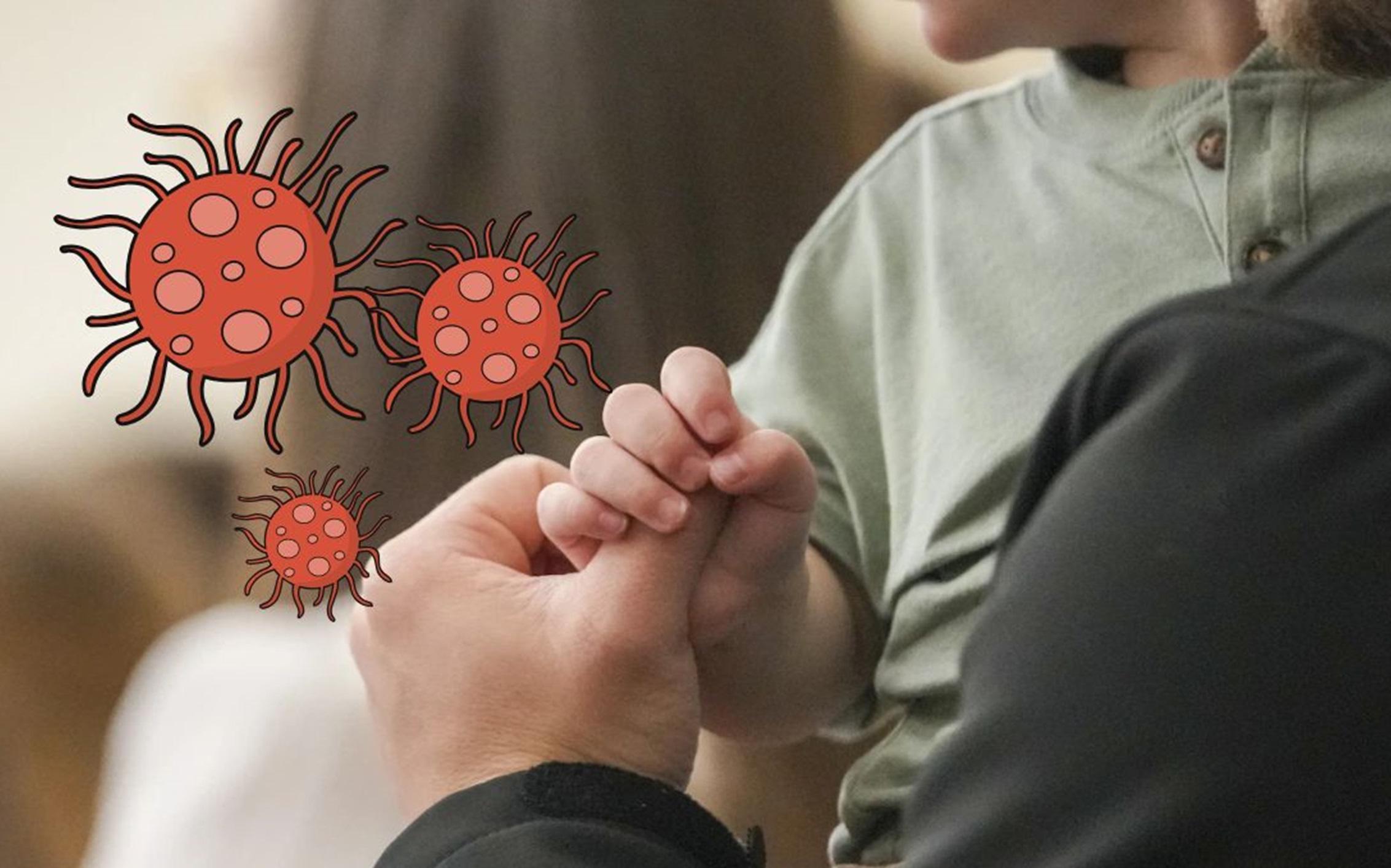 Niños menores de 5 años, los más contagiados por sarampión. AP / ARCHIVO