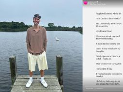 La salud mental de Justin ha sido objeto de debate en las redes en los últimos meses. Instagram: @justinbieber