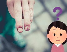 Si notas moretones sin un golpe evidente, es importante no ignorarlos. Podrían ser indicativos de un problema de salud más grave. UNSPLASH / M. Spiske