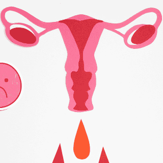 ¿Estos dolores menstruales son normales o podría ser endometriosis?
