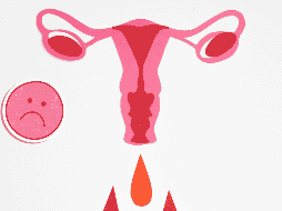 La endometriosis puede confundirse con otras afecciones, como quistes ováricos, enfermedad inflamatoria pélvica o síndrome del intestino irritable. CANVA / N. Moryak