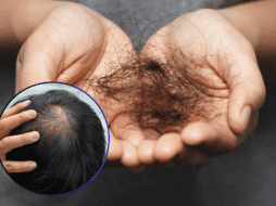 El cabello tiene un gran peso en la imagen personal de una persona, debido a su valor estético. ESPECIAL