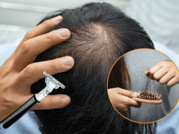 “Esta situación puede afectar la autoestima, pero se debe tener cuidado con las decisiones que se adopten para revertir este proceso”, alertó Medina Bojórquez. ESPECIAL