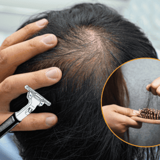 ¿Raparse empeora la alopecia? Esto dicen los especialistas