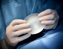 Los implantes se cambian por diferentes razones. UNSPLASH / P. SPITALIER