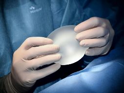 Los implantes se cambian por diferentes razones. UNSPLASH / P. SPITALIER