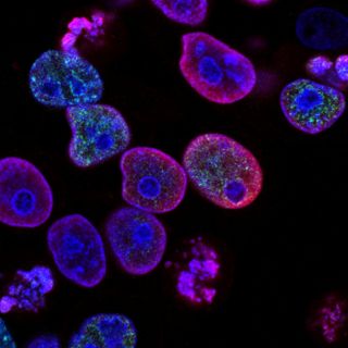 Investigadores desarrollan modificación genética de las células del sistema inmune