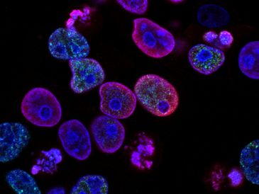 La investigación ha contado con la colaboración de investigadores de diferentes partes de Europa. UNSPLASH / NCI