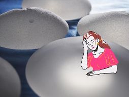 La enfermedad por implantes mamarios aún no tiene un diagnóstico oficial. UNSPLASH / P. SPITALIER