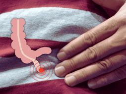 En el IMSS se realiza la operación para retirar el apéndice, se sutura el intestino y no tiene mayor cuidado. EL INFORMADOR / O. Álvarez