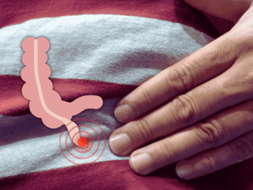 En el IMSS se realiza la operación para retirar el apéndice, se sutura el intestino y no tiene mayor cuidado. EL INFORMADOR / O. Álvarez