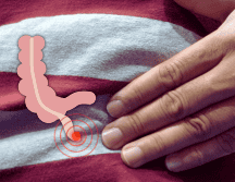 En el IMSS se realiza la operación para retirar el apéndice, se sutura el intestino y no tiene mayor cuidado. EL INFORMADOR / O. Álvarez