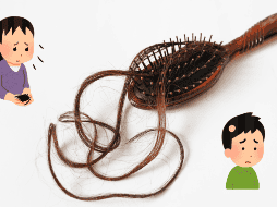 Identifica el tipo de alopecia que tienes. ESPECIAL / Pixabay @pimnana