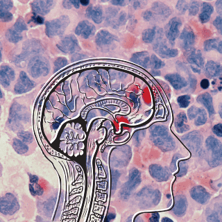 Virus del herpes podría traer repercusiones en la salud neuronal