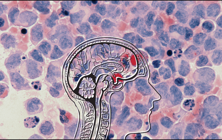Un diagnóstico temprano podría permitir intervenciones más efectivas para evitar el deterioro neurológico. UNSPLASH / National Cancer Institute