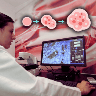 Las dos pruebas EFECTIVAS para detectar el cáncer colorrectal