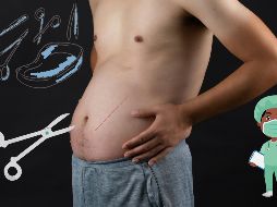 La edad principal en la que los hombres se someten a cirugías estéticas es a los 40 años, que es la edad promedio de la aparición de los primeros signos de envejecimiento. ESPECIAL / UNSPLASH / S. SEAN / CANVA