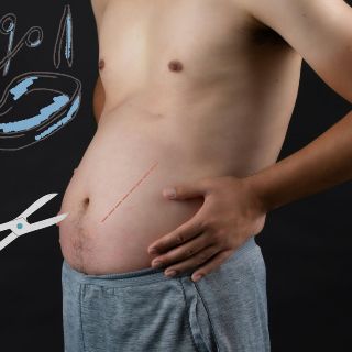 ¿Cuáles son las cirugías plásticas más solicitadas por los hombres?