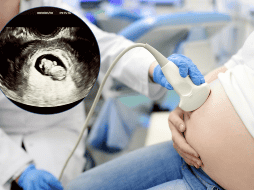 El desarrollo fetal es un proceso ordenado y preciso, donde cada sistema y parte del cuerpo crece en un momento específico para asegurar la formación adecuada del ser humano. 
 CANVA