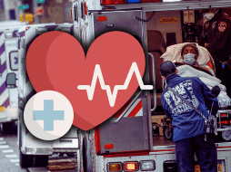 Se le conoce como infarto agudo de miocardio, o también llamado ataque al corazón, a la necrosis o 