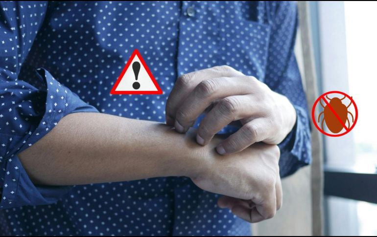 Si tienes chinches en casa, lo más recomendable para su exterminio es acudir con profesionales. Pexels y Canva