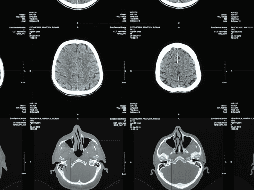 Investigaciones recientes señalan que el entrenamiento de fuerza no solo fortalece los músculos, sino que también beneficia la salud cerebral. Canva / O. Fedorchuk