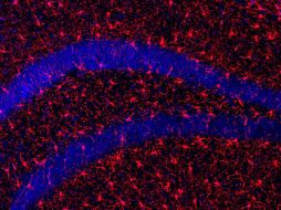 Con la edad, es natural que los seres humanos pierdan masa muscular y ósea, lo que conlleva un aumento de la debilidad, que puede derivar en caídas y lesiones importantes. EFE / ARCHIVO