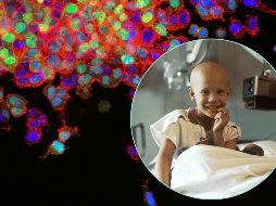 A diferencia del cáncer en adultos, donde existen pruebas de tamizaje, en los menores el diagnóstico depende de la observación clínica. UNSPLASH /  National Cancer Institute